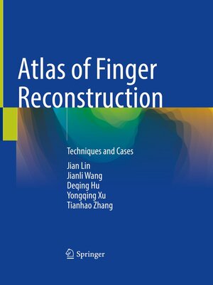 cover image of Atlas of Finger Reconstruction